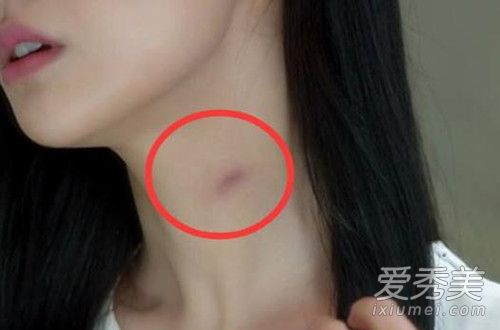 网络用语种草莓是什么意思 种草莓怎么快速消除