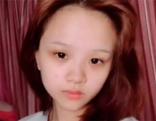 抖音网红罗百万鼻子哪里整的 罗百万整容前后对比照片