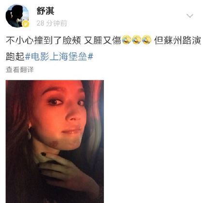 舒淇撞伤脸颊发肿怎么回事 舒淇撞伤脸网友赞敬业