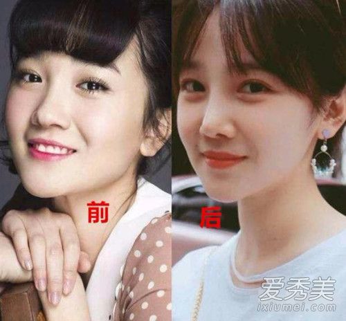 陈小纭整容了吗 陈小纭整容前后照片对比