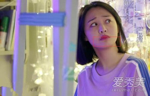郑爽嘴角伤疤图片 郑爽嘴角伤疤怎么来的