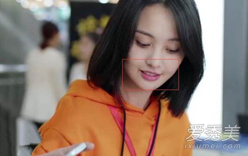 郑爽嘴角伤疤图片 郑爽嘴角伤疤怎么来的