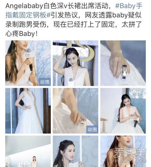 Baby戴固定钢板 背后原因令人心酸又无奈!