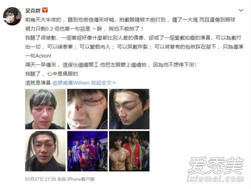 威廉拍戏出意外 背后原因让人心疼