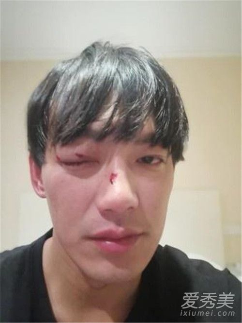 威廉拍戏出意外 背后原因让人心疼