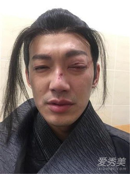 威廉拍戏出意外 背后原因让人心疼