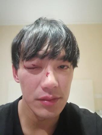 威廉拍戏出意外 背后原因曝光让人心疼