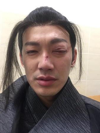 威廉拍戏出意外 背后原因曝光让人心疼