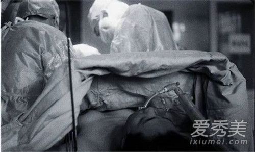 金星为什么要做变性手术 金星自述变性手术全过程图片