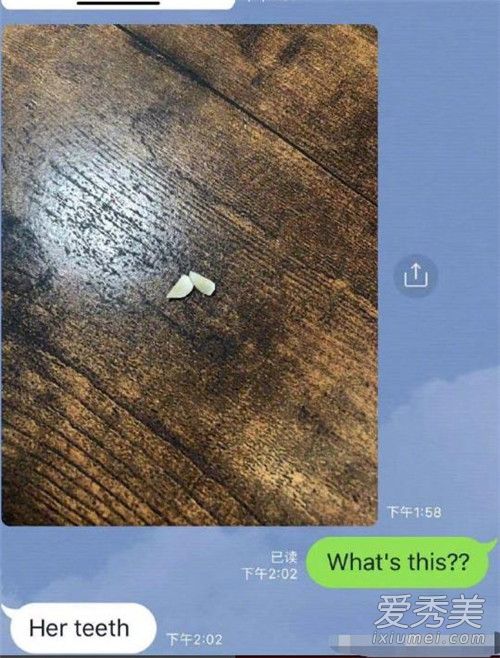 疑中浦悠花好友曝光验伤报告出炉 被打掉两颗牙齿身体多处受伤！
