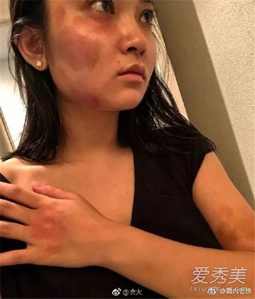 蒋劲夫律师回应家暴 打断牙齿房间很多血都不属实