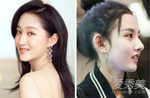 章若楠是什么脸型 章若楠是不是整鼻子了