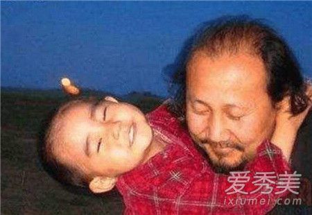 腾格尔女儿什么病死的 腾格尔女儿嘎吉尔瘫痪图片