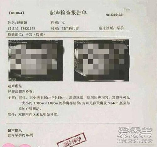 赵丽颖回怼爆料什么情况 赵丽颖回怼爆料怎么说的
