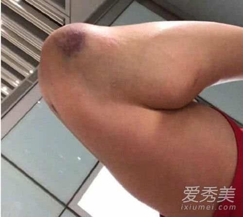 李易峰力挺郭艾伦是怎么回事 李易峰为什么力挺郭艾伦说了什么