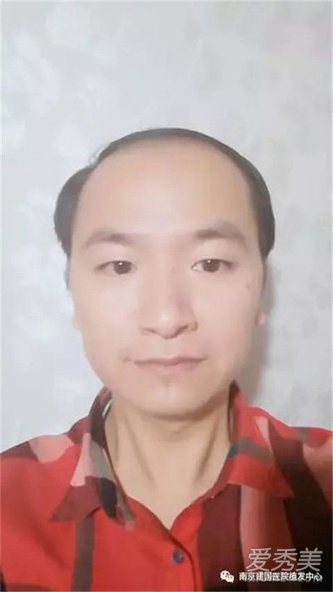 朋友圈很火的中年男子是谁 朋友圈秃头地中海男子是什么梗