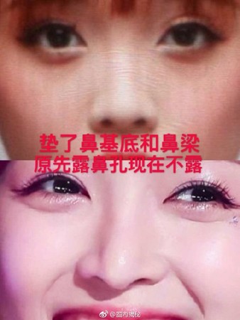吴宣仪整容对比照流出 吴宣仪整了哪些地方