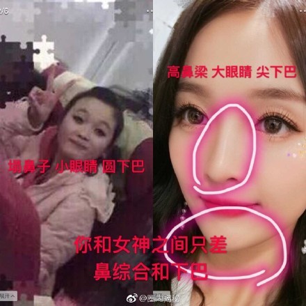 吴宣仪整容对比照流出 吴宣仪整了哪些地方