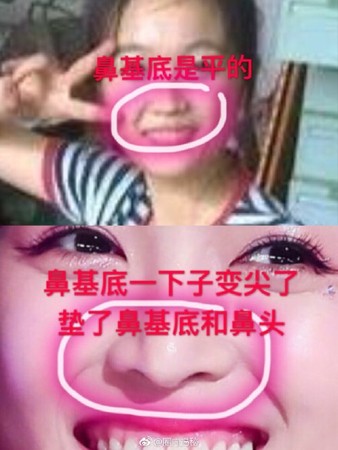 吴宣仪整容对比照流出 吴宣仪整了哪些地方