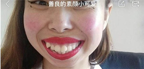 网红嘟嘟姐快手号是多少 嘟嘟姐一夜爆火吸金百万的原因
