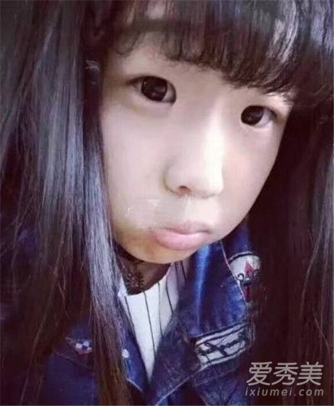 温婉整容了嘛 抖音温婉整容的医院是哪家