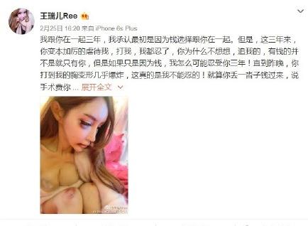 真家暴OR炒作，王瑞儿胸被打爆是真的吗？