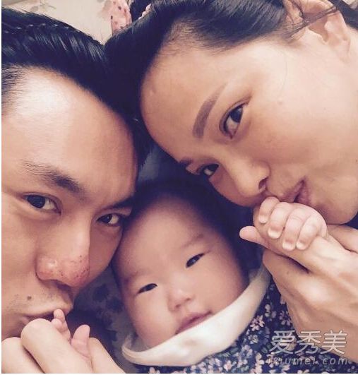 伊能静女儿伤势严重吗 伊能静女儿怎么受伤的