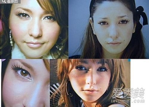 藤井莉娜的痣是真的吗 藤井莉娜整容前后对比照片