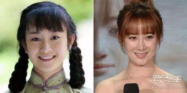 张檬回应整容是怎么回事 张檬整容前后照片对比