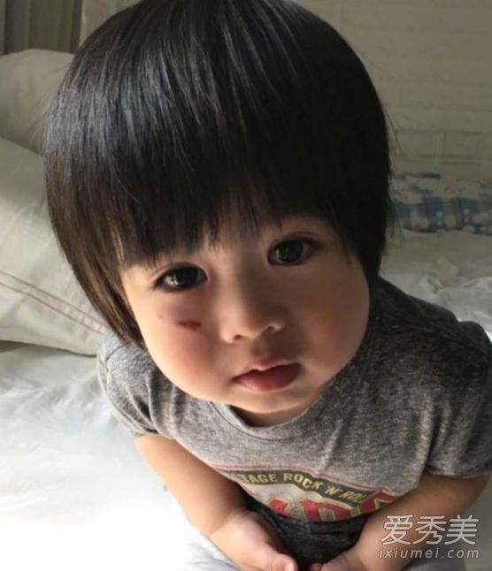 林志颖儿子跌伤脸 Kyson伤口发红令人心疼