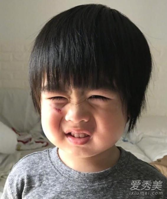 林志颖儿子跌伤脸 Kyson伤口发红令人心疼