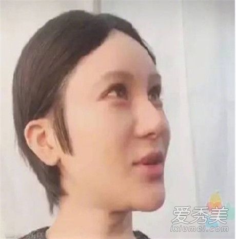 尚雯婕整容前后照片对比 尚雯婕整容失败好吓人