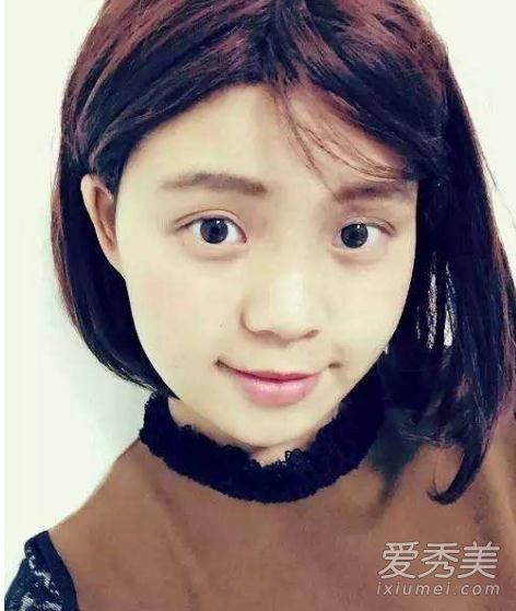 抗癌周琳结婚了没有 抗癌女孩周琳多少岁