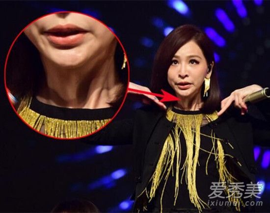 王心凌的脸怎么了？整容失败跌落神坛的10大女星