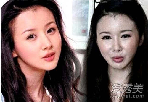 王心凌的脸怎么了？整容失败跌落神坛的10大女星
