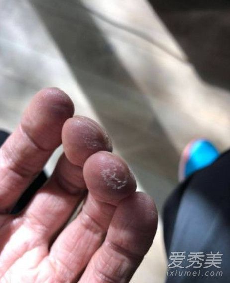 谢霆锋脚纹解锁是怎么回事 谢霆锋为什么要用脚纹解锁