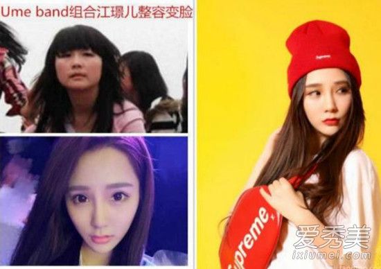 创造101江璟儿整容了吗 江璟儿整容前长什么样