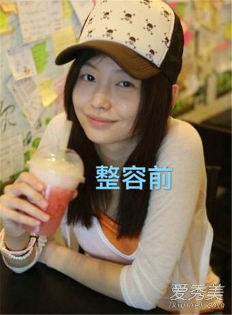 于文文整容前后图片 整容前的于文文居然更好看？