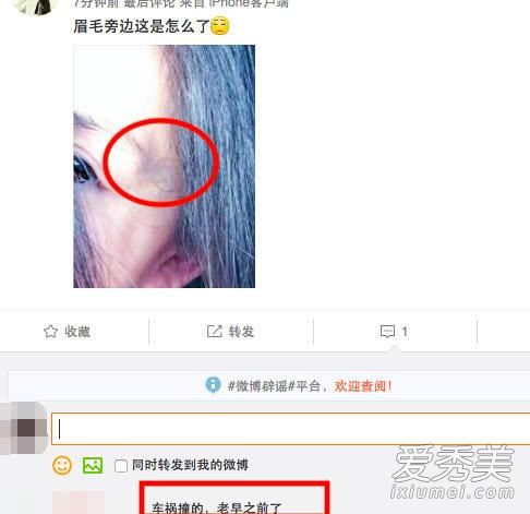 谢娜晒产后晒照好憔悴是怎么回事 产后多久可以恢复好