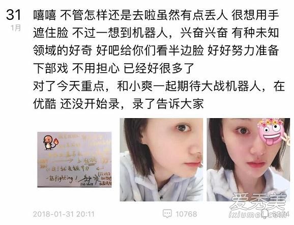 郑爽眼睛受伤 右眼肿起贴纱布出席活动