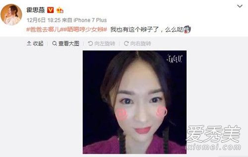 霍思燕晒嗯哼同款少女辫卖萌搞怪显俏皮 嗯哼少女辫什么软