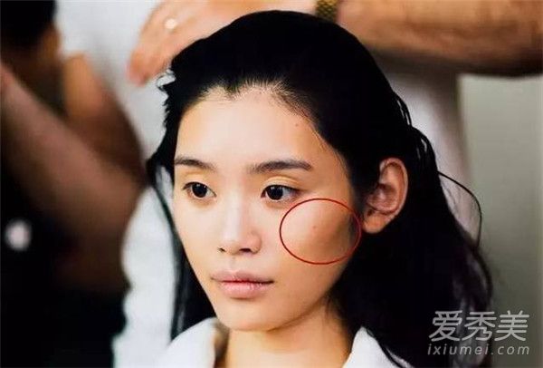 天生高级脸的奚梦瑶真的不适合面填啊！谁推荐她去整容的
