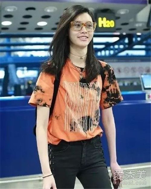 天生高级脸的奚梦瑶真的不适合面填啊！谁推荐她去整容的