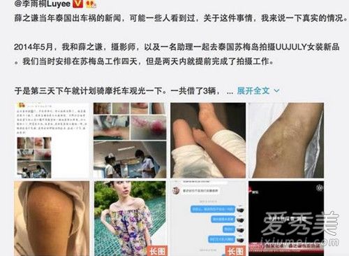 薛之谦删车祸微博是怎么回事 薛之谦车祸后整容了吗