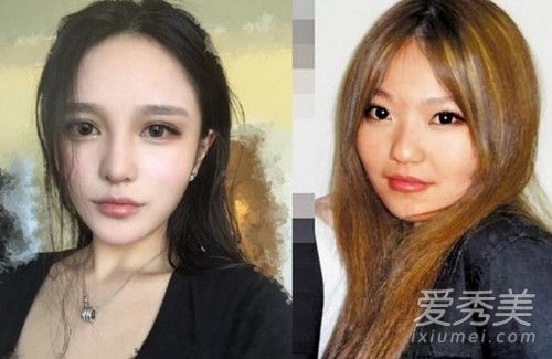 周扬青整容整了哪里 周扬青整容前后对比照