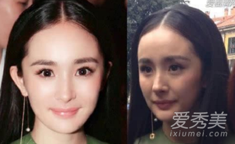 杨幂的脸撑不了多久了 杨幂的脸快跨了吗