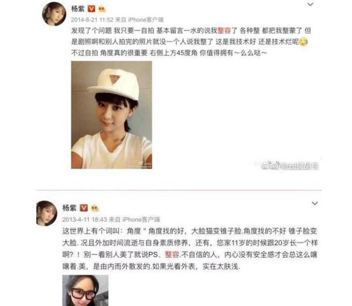 杨紫现身整形医院 杨紫整容了吗去整形医院做什么