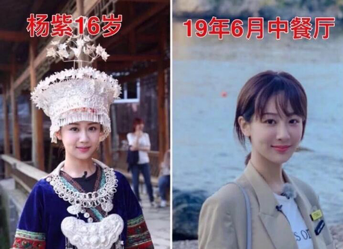 杨紫现身整形医院 杨紫整容了吗去整形医院做什么