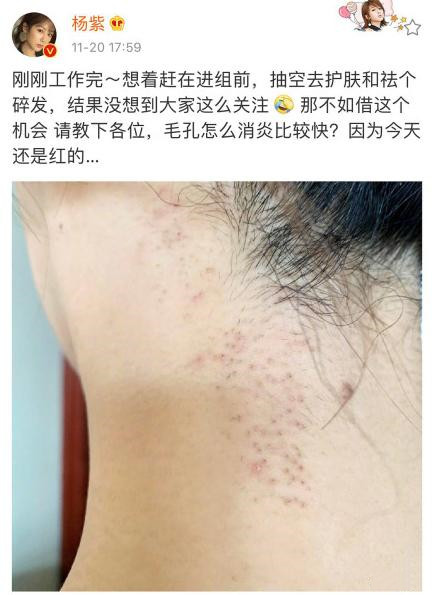 杨紫回应现身整形美容医院：在线求教如何护肤