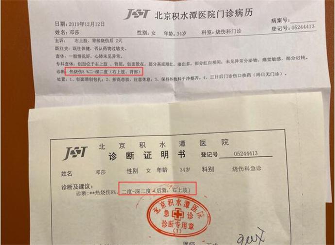 邓莎拔火罐被烧伤 现场照曝出皮肉外翻太吓人了